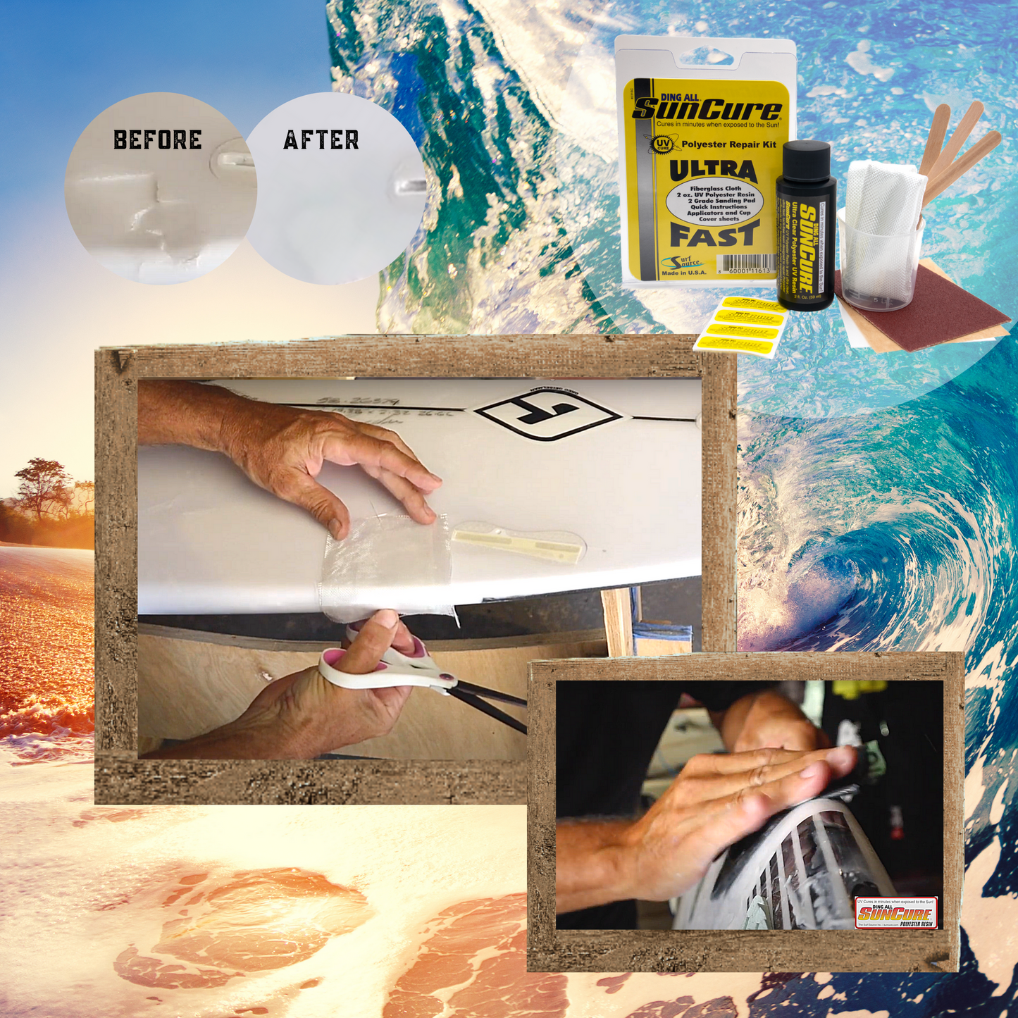 SunCure Ding Repair Kit